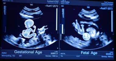 differences in gestational timing